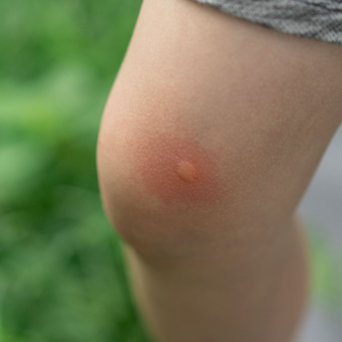 Roll-on <span>Apaistic</span>